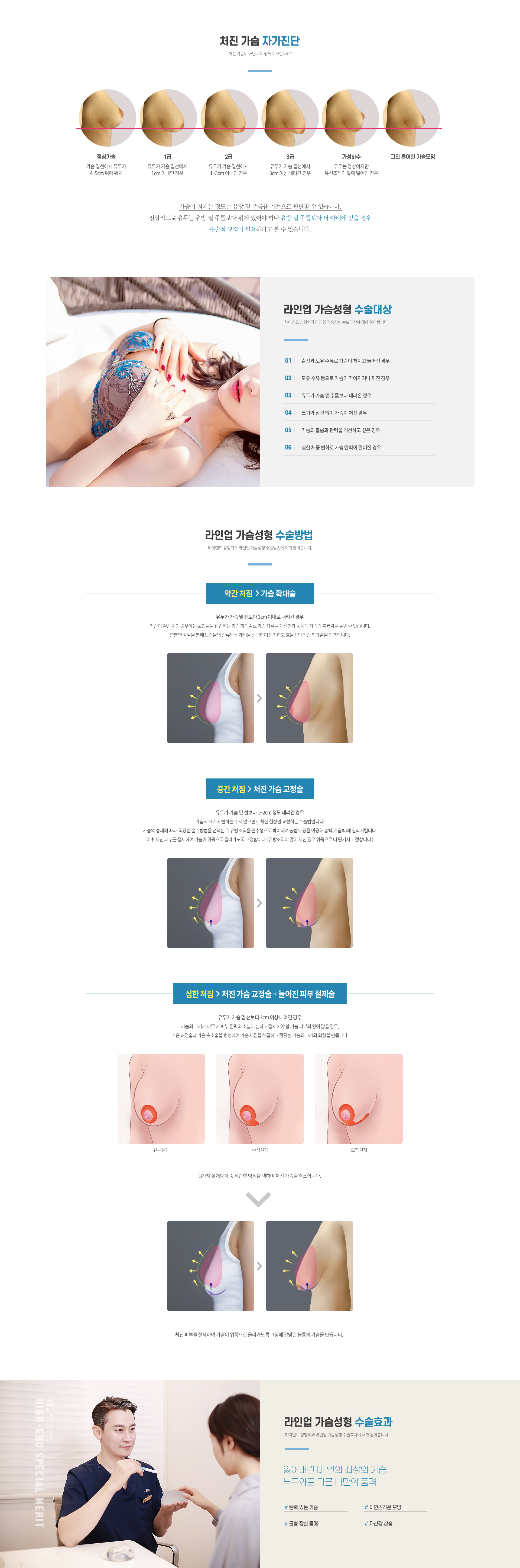 하이엔드 가슴성형 라인업 가슴성형 