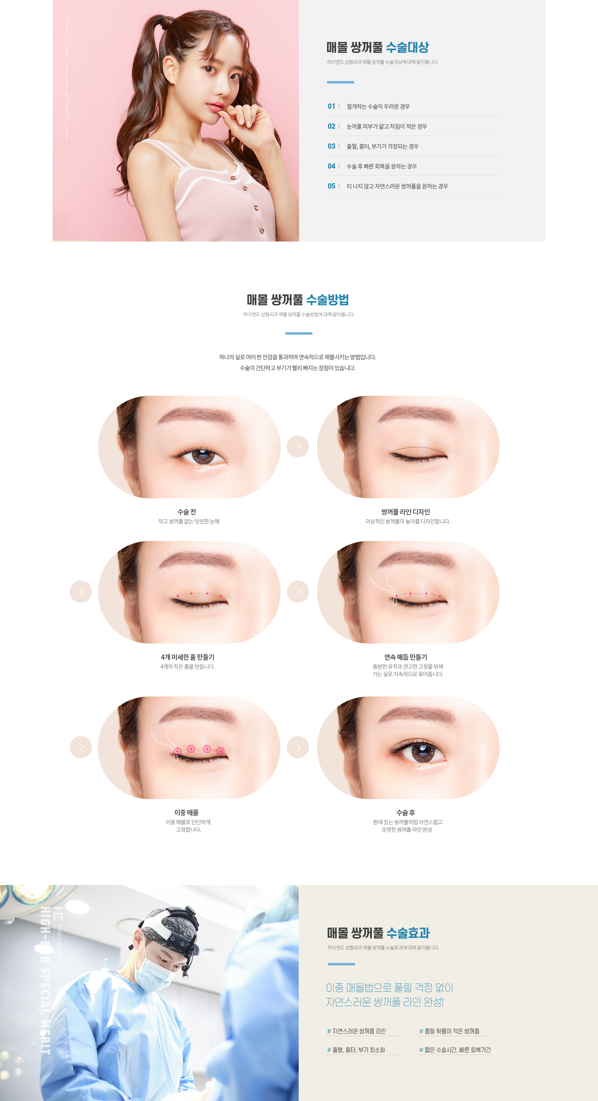 하이엔드 눈성형 매몰 쌍꺼풀