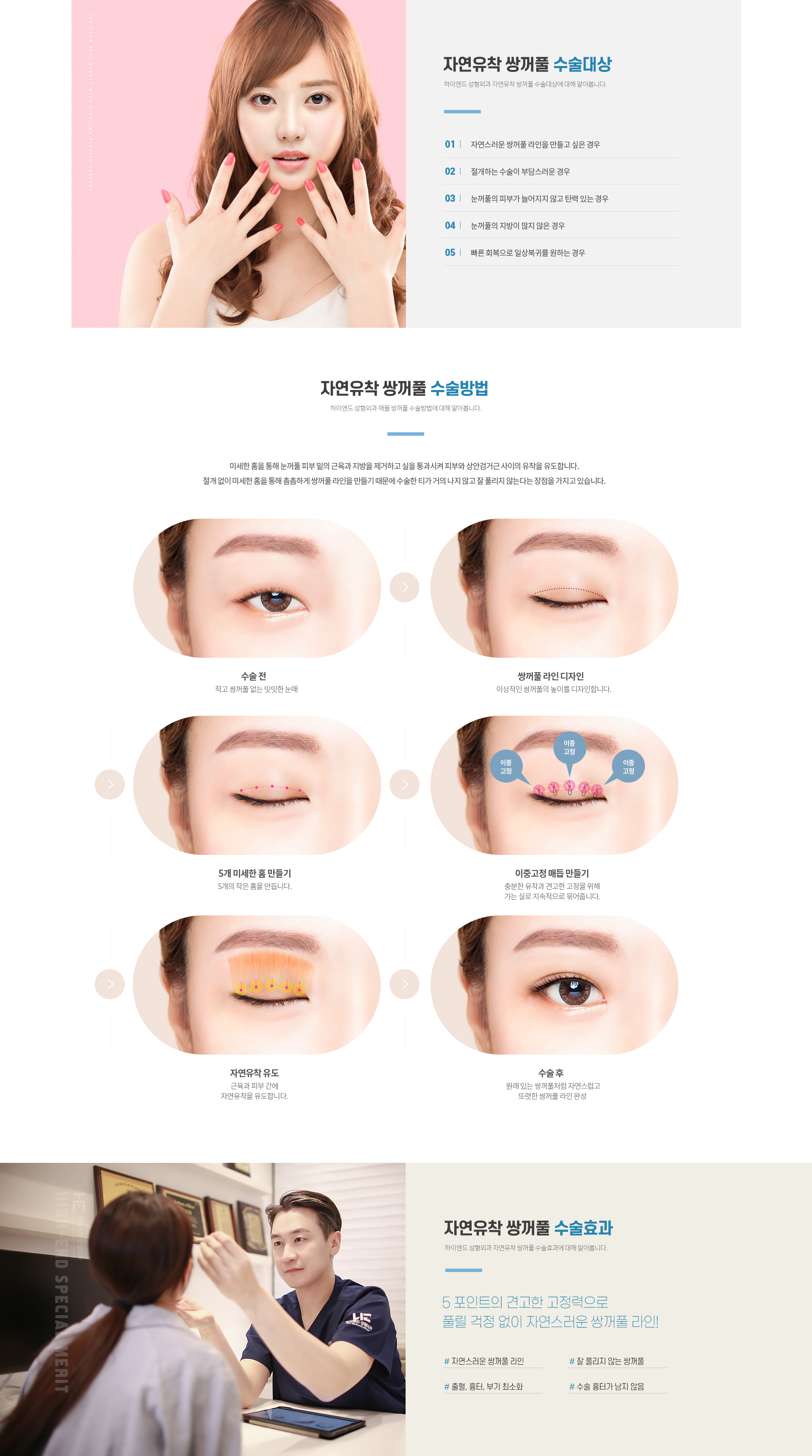 하이엔드 눈성형 자연유착 쌍꺼풀