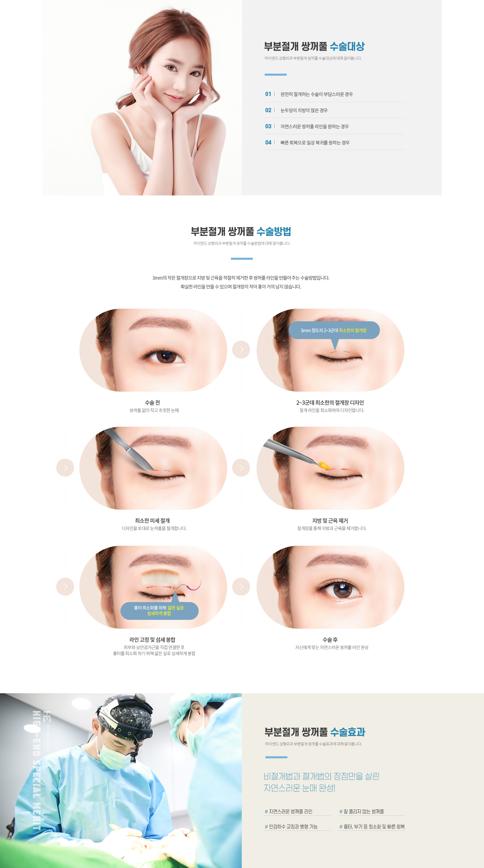하이엔드 눈성형 부분절개 쌍꺼풀