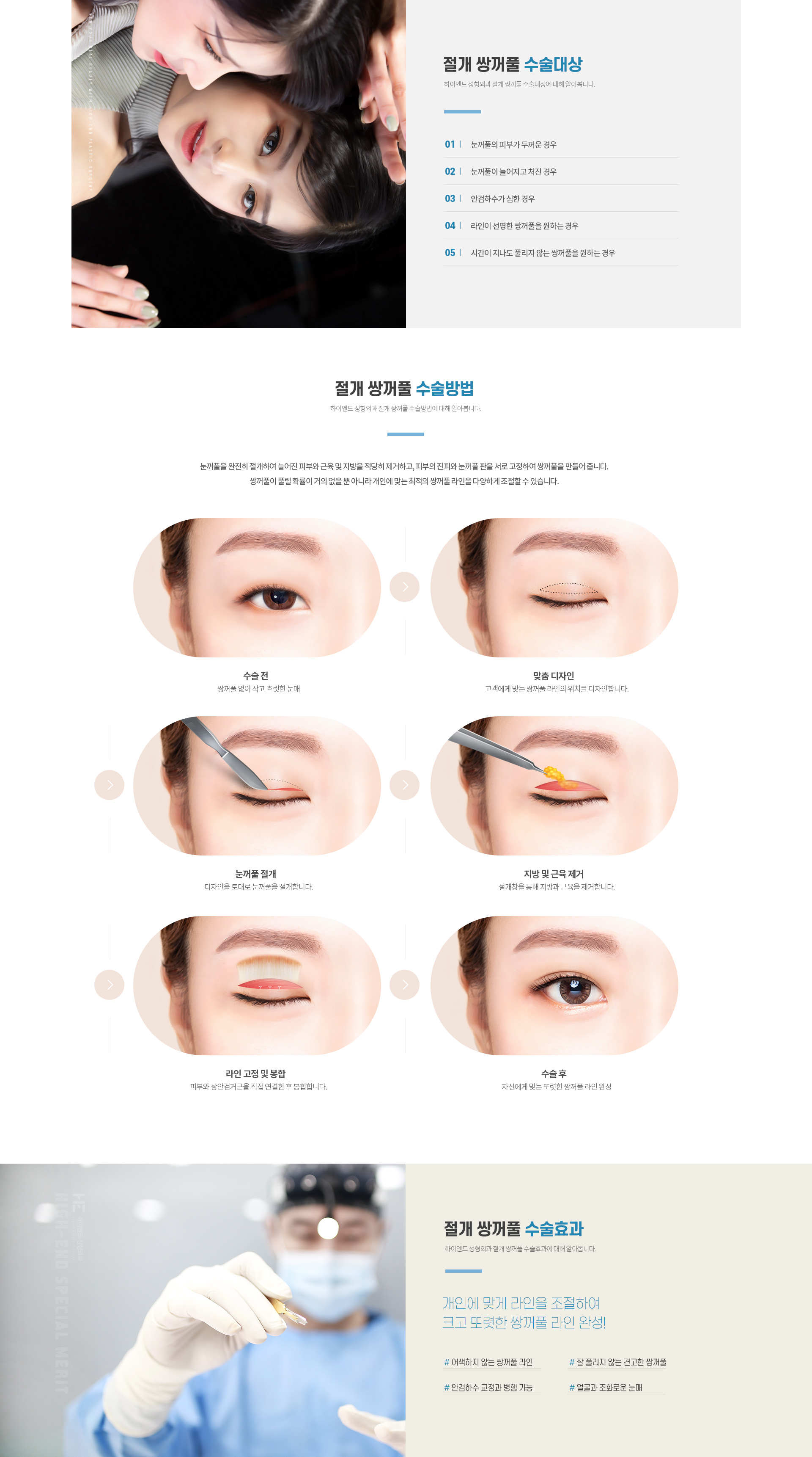 하이엔드 눈성형 절개 쌍꺼풀