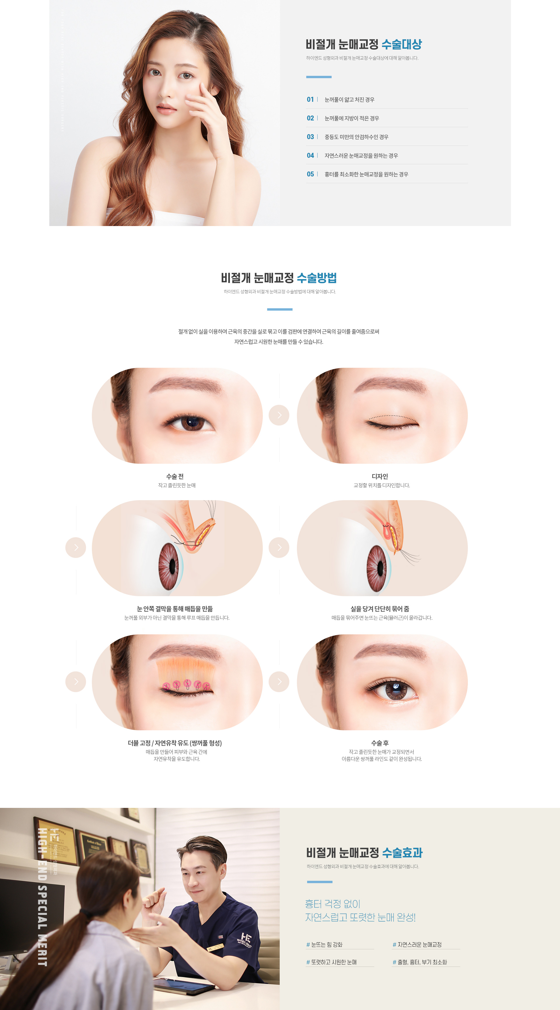 하이엔드 눈성형 비절개 눈매교정