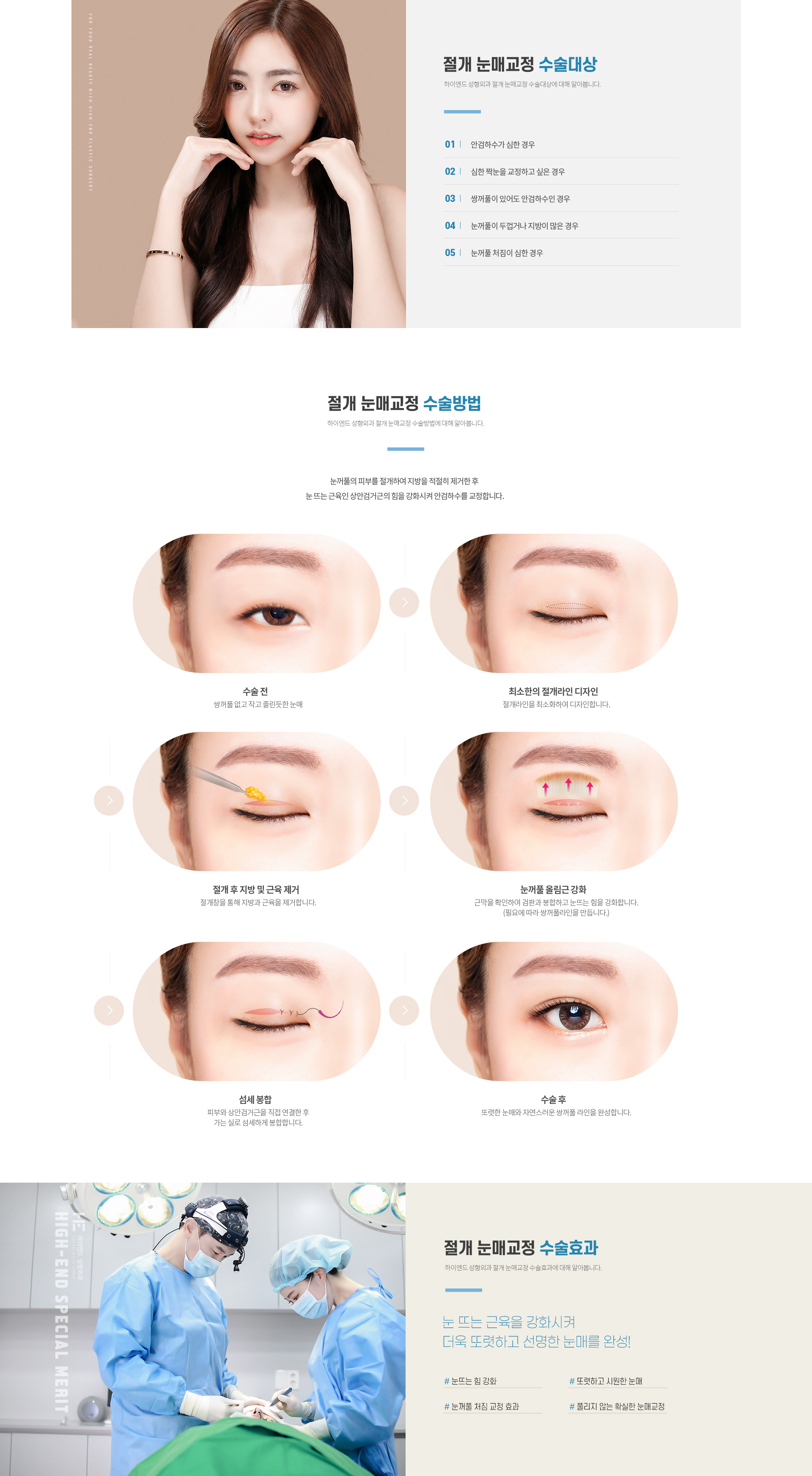 하이엔드 눈성형 절개 눈매교정