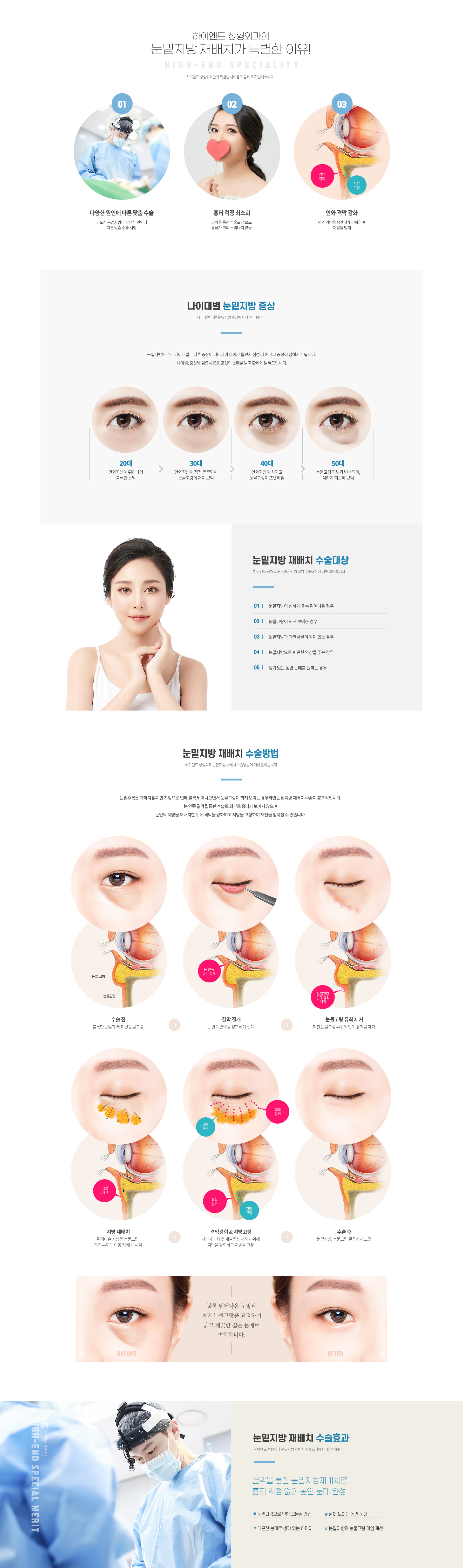 하이엔드 눈성형 눈밑지방 재배치