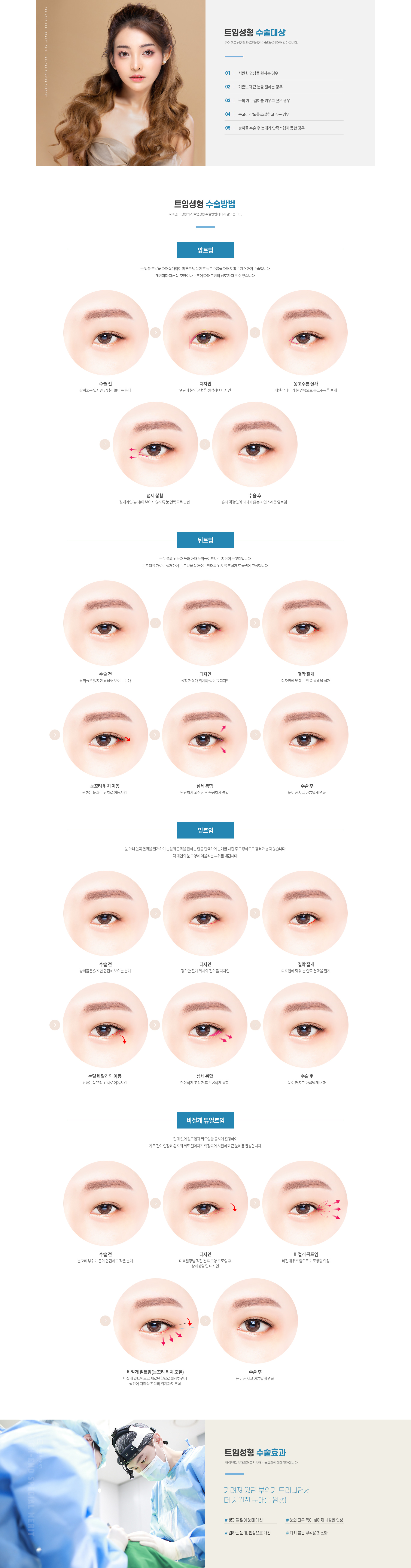 하이엔드 눈성형 트임성형
