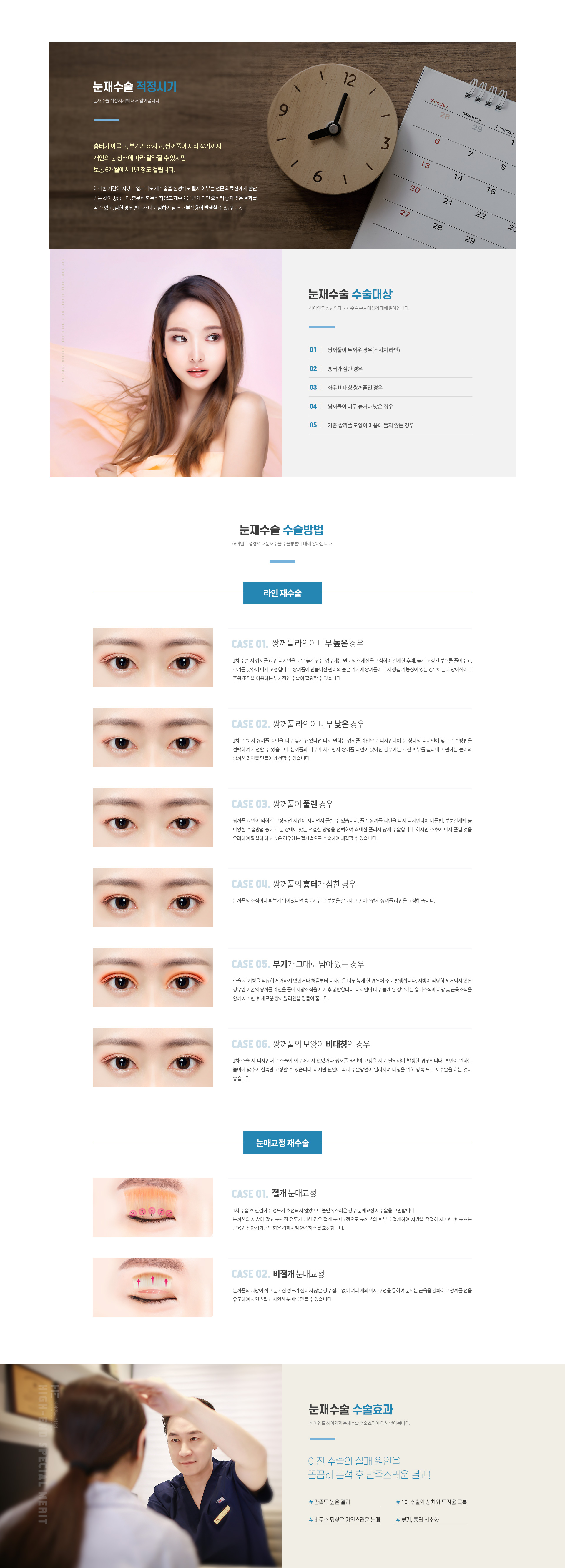 하이엔드 눈성형 눈재수술