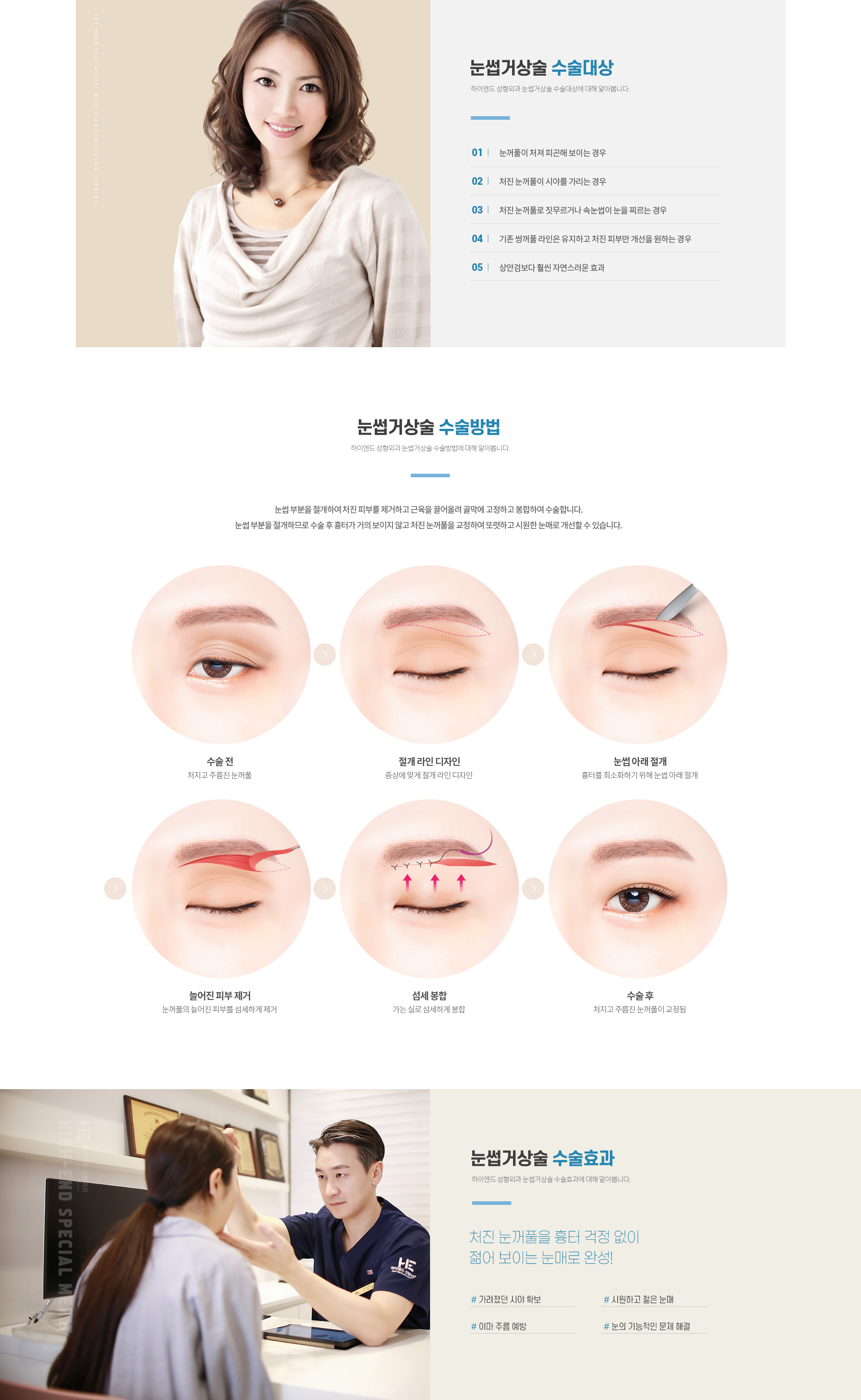 하이엔드 중년 눈성형 눈썹거상술