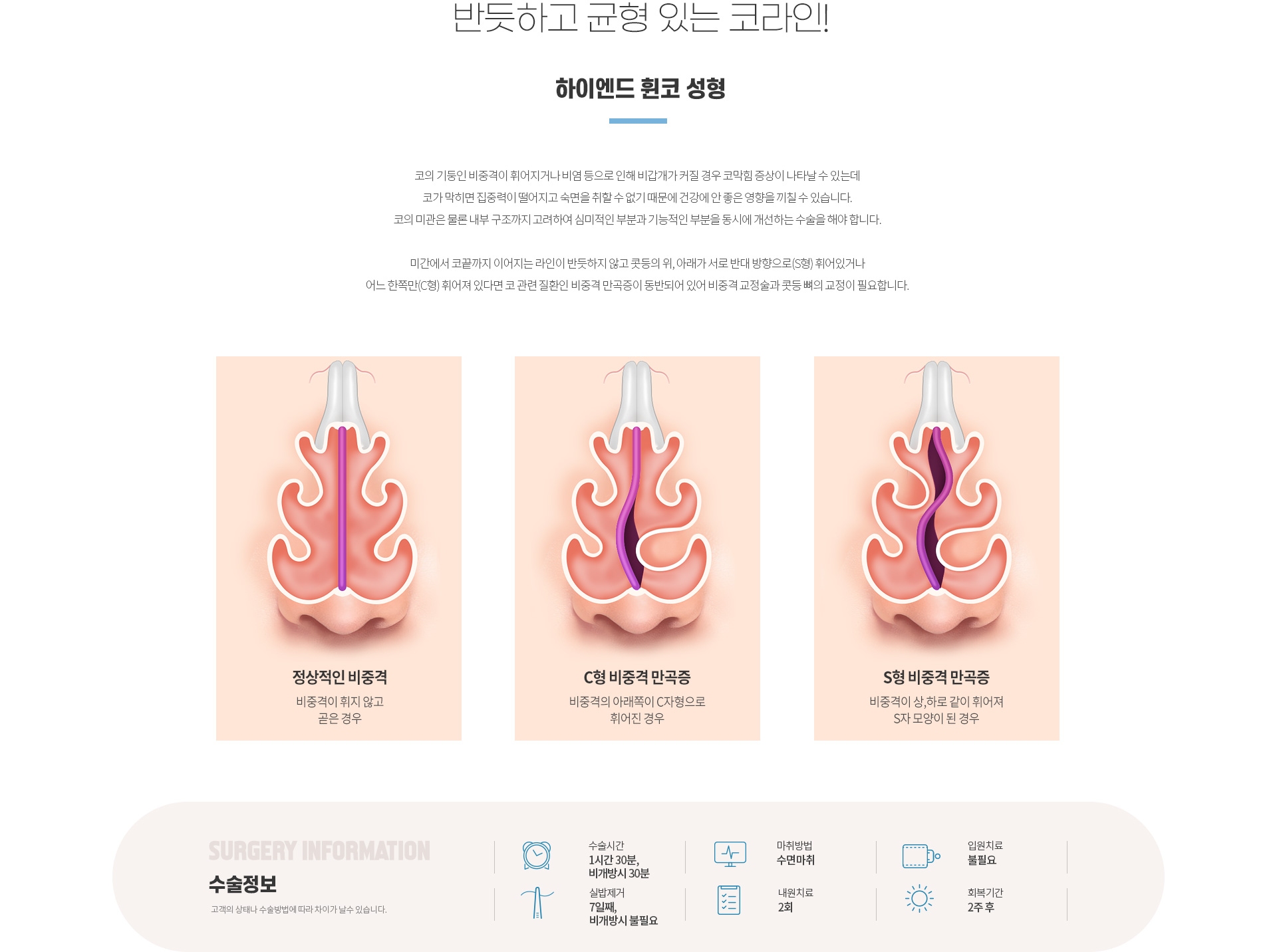 하이엔드 유형별 코성형 휜코