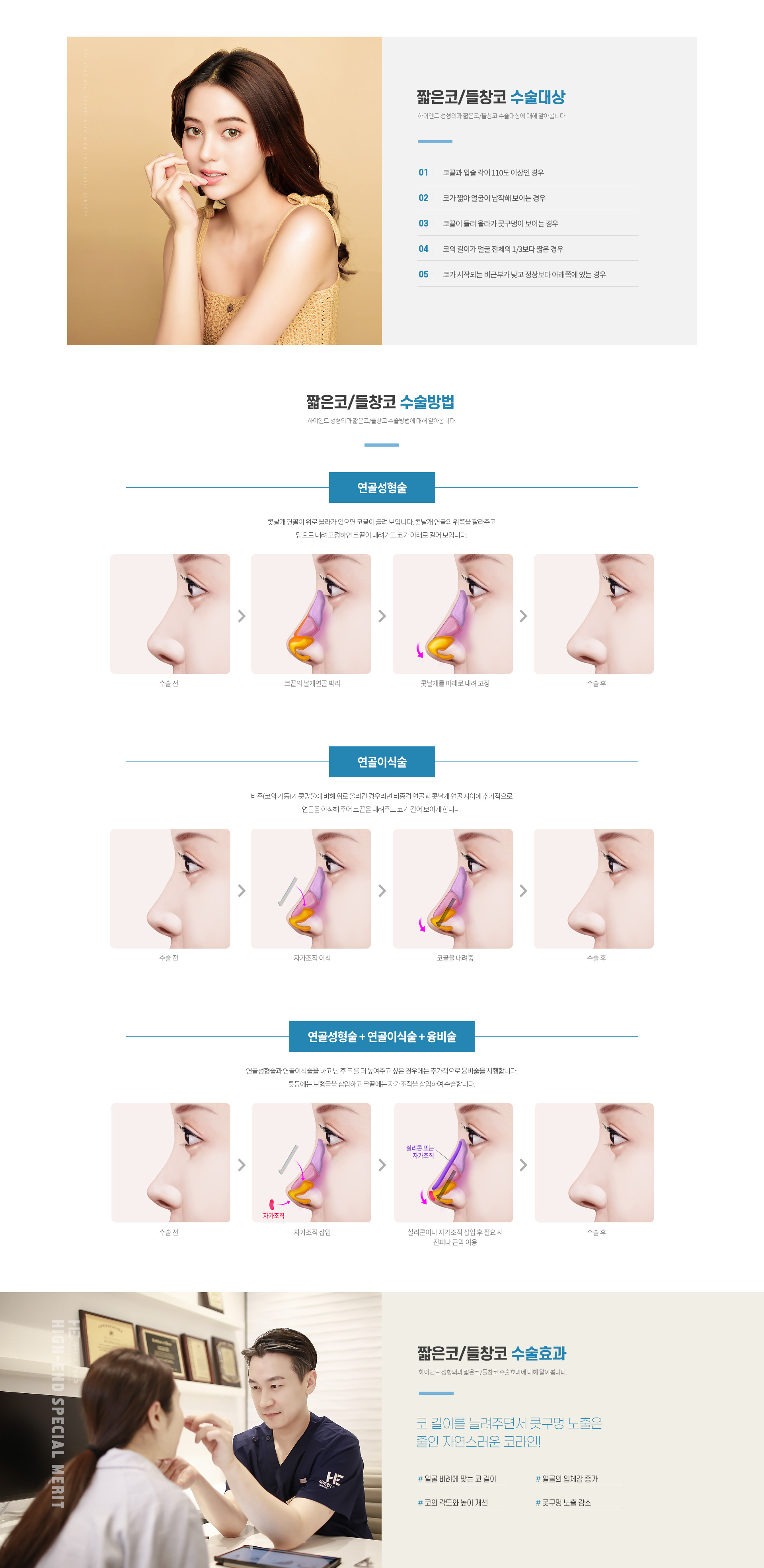 하이엔드 유형별 코성형 짧은코/들창코