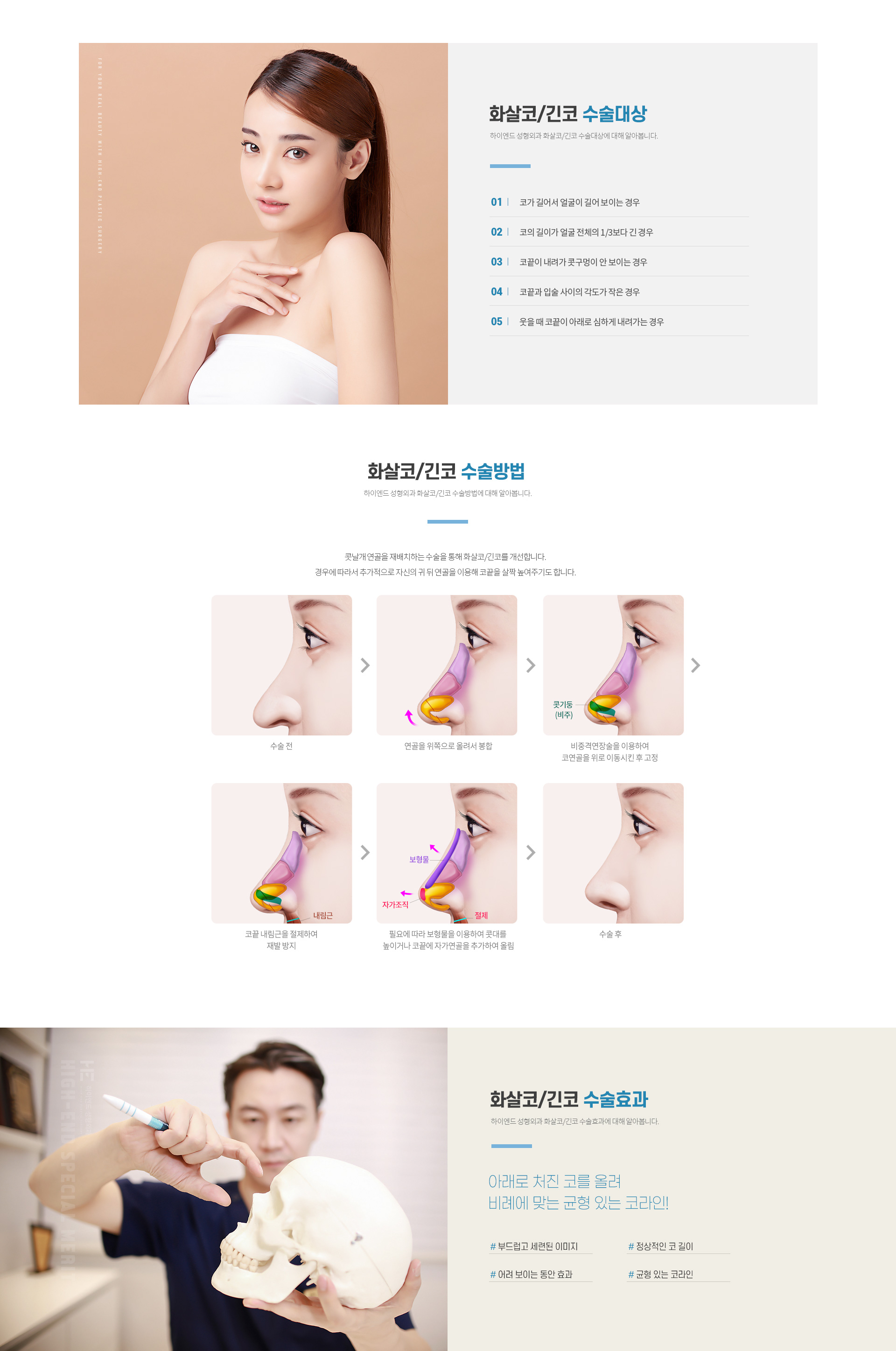 하이엔드 유형별 코성형 화살코/긴코