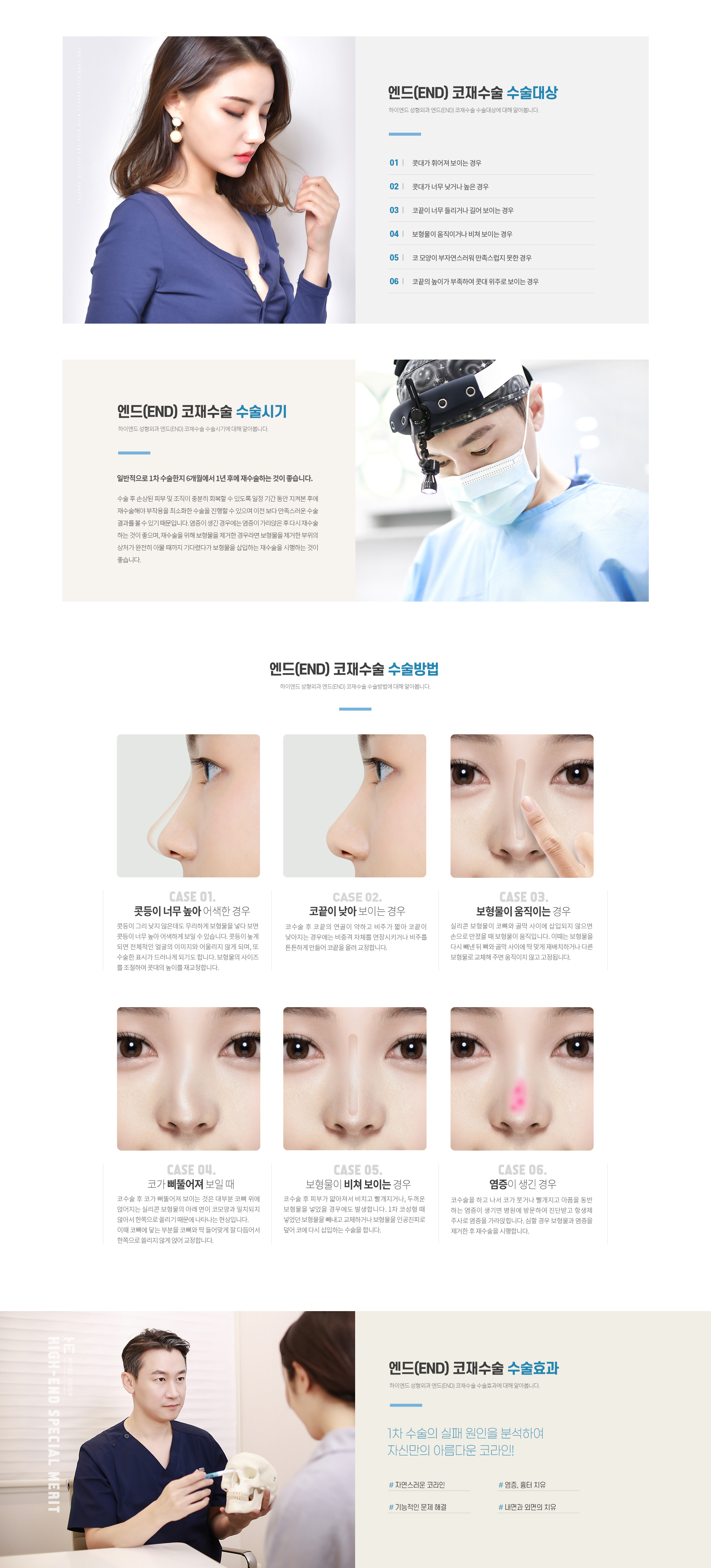 하이엔드 엔드(end) 코재수술