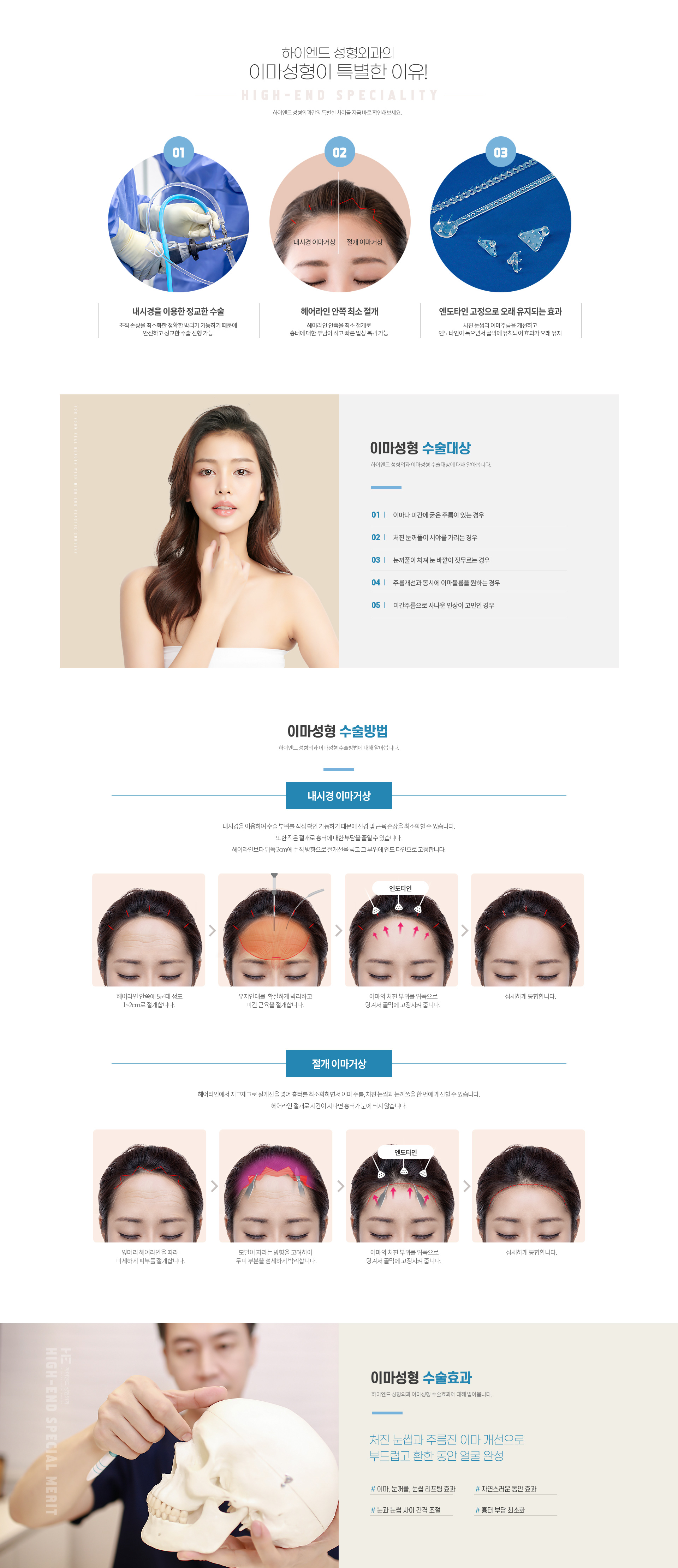 하이엔드 동안/리프팅/쁘띠 이마성형